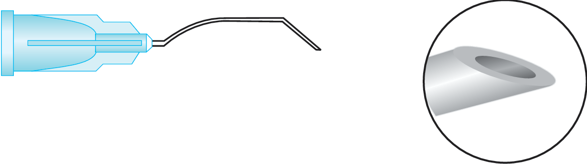 Retrobulbar (Curved Atkinson)
